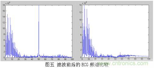 采用MSP430設(shè)計的12位心電(ECG)放大器